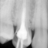 Endodoncja